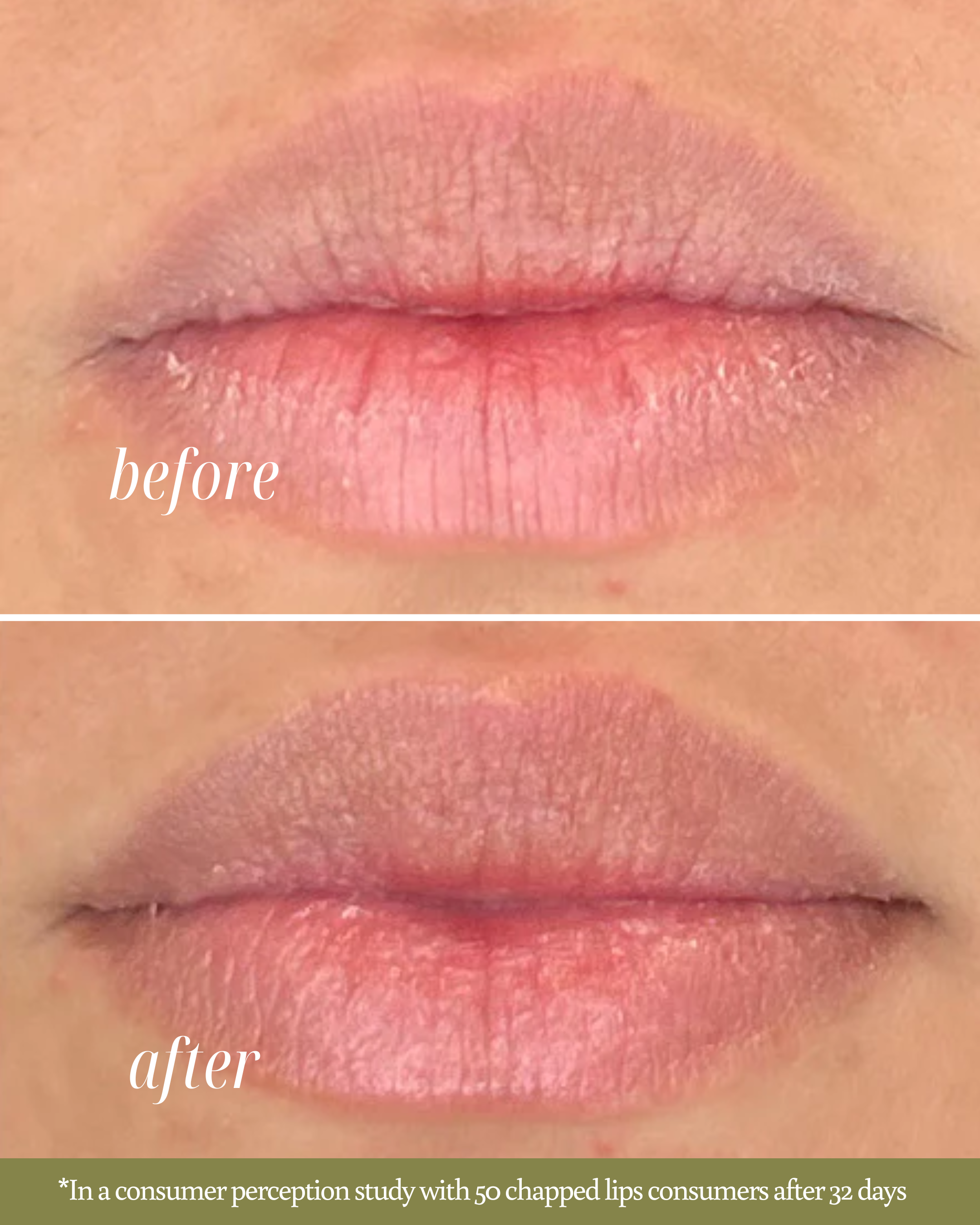 Close-up before-and-after image showing improvement in chapped lips after using Café Éclat Lip Scrub. The ‘before’ lips appear dry and flaky, while the ‘after’ lips look smoother and moisturized.
