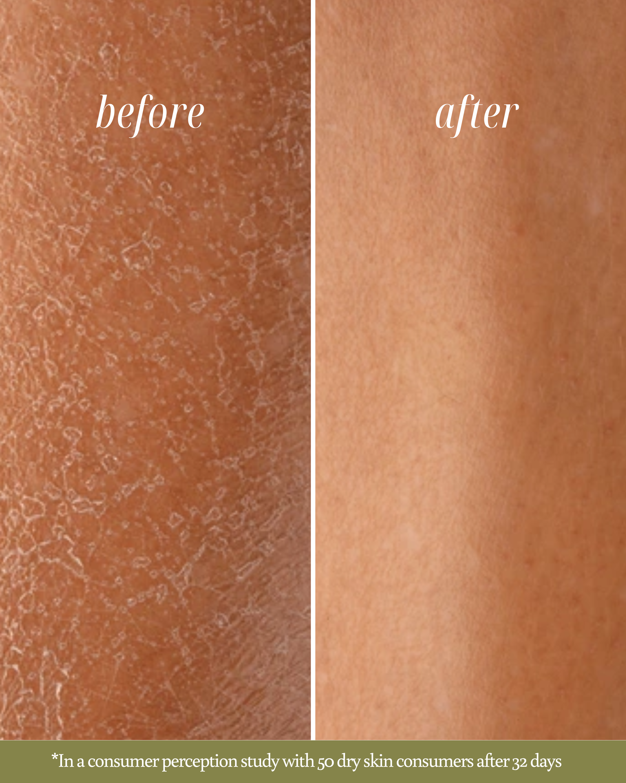 Before and after comparison of dry skin texture with text reading "In a consumer perception study with 50 dry skin consumers after 32 days"
