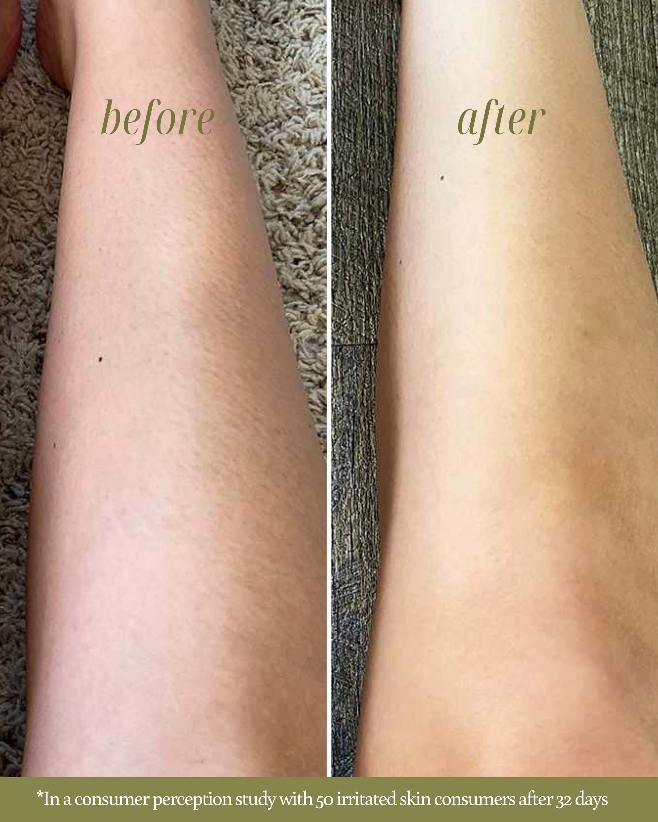 Before and after comparison of irritated skin on a person's arm with text indicating consumer perception study results.