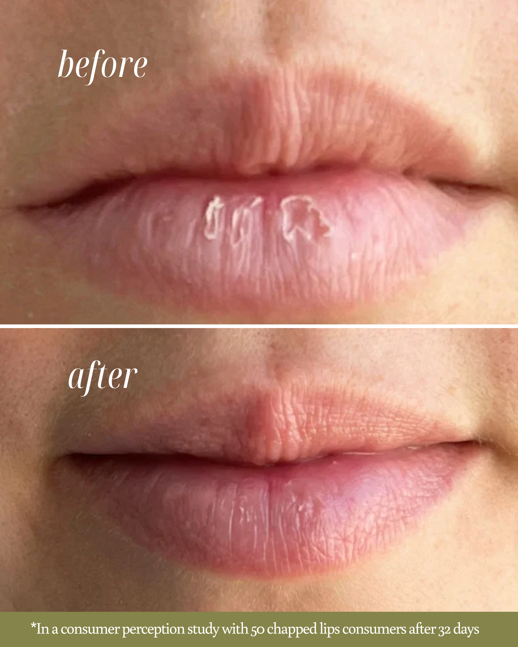 Close-up before-and-after image showing improvement in chapped lips after using Ruby Reverie Lip Balm. The ‘before’ lips appear dry and flaky, while the ‘after’ lips look smoother, moisturized, and instantly tinted.