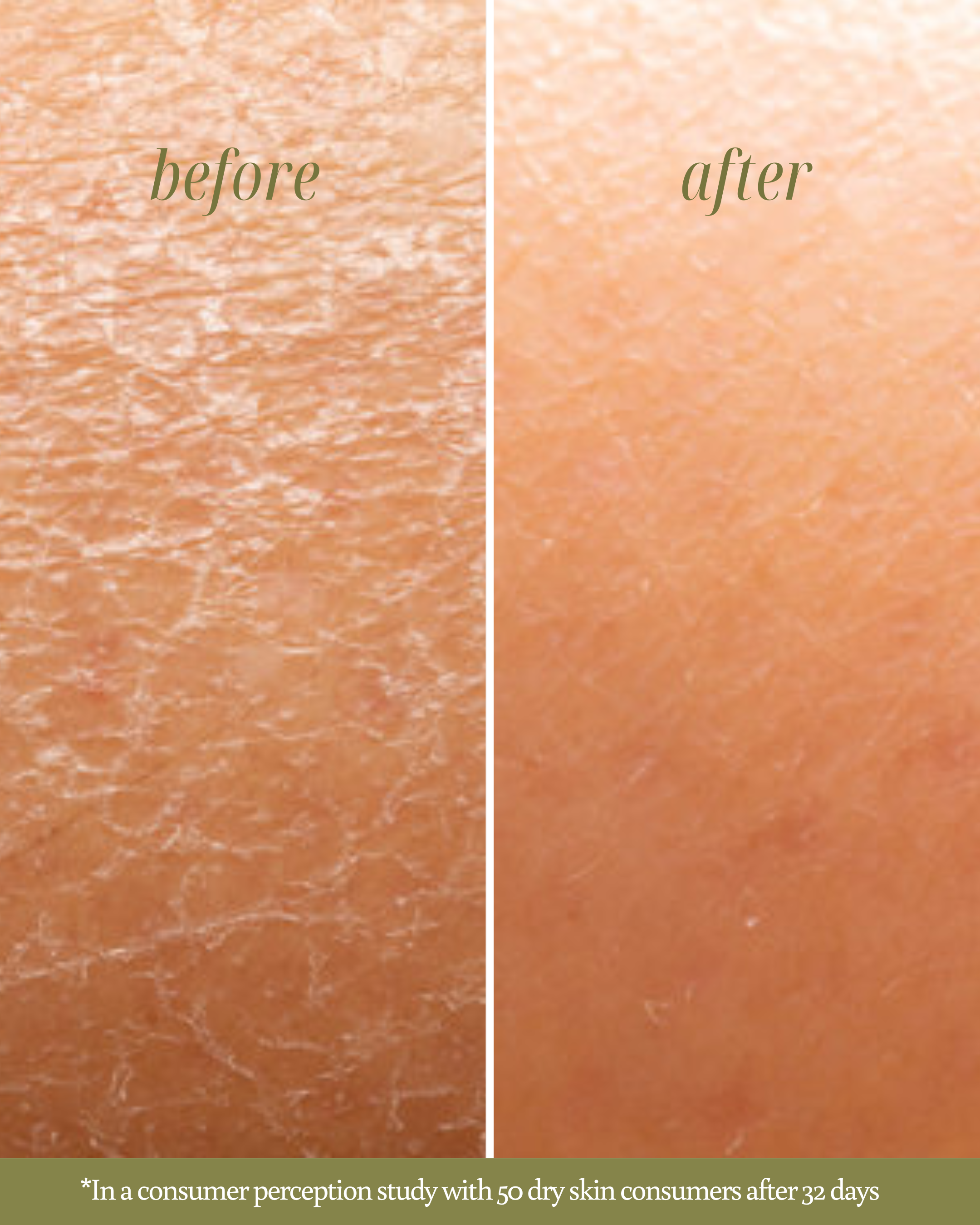 Before and after comparison of dry skin texture with text indicating a consumer perception study.