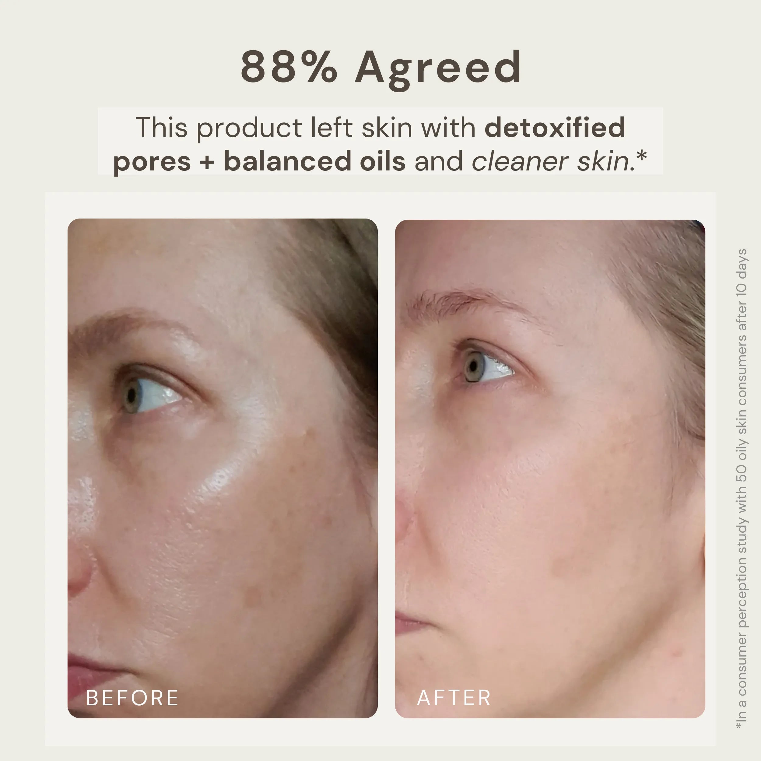 Before and after image of a person’s face showing the results of using Nature’s Circle Care Bentonite Harmony Clay Mask. The 'Before' image displays oily skin with visible pores, while the 'After 10 Days' image shows a more balanced complexion with detoxified pores and clearer skin. Text highlights that 88% of users agreed the product left their skin with detoxified pores, balanced oils, and cleaner skin, based on a consumer perception study with 50 oily skin participants after 10 days.