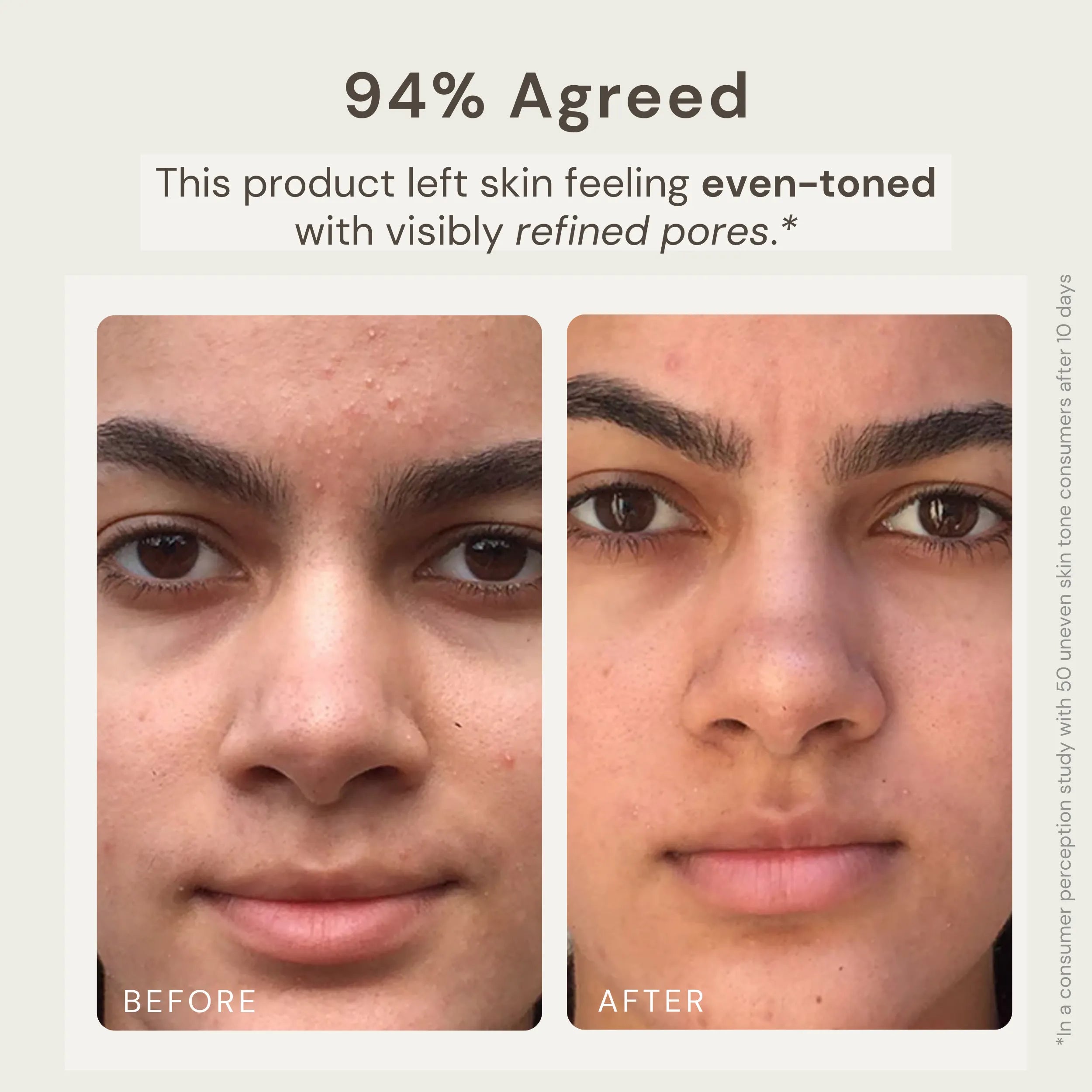Before and after image of a person’s face showing the results of using Nature’s Circle Care Earth Radiance Clay Mask. The 'Before' image displays uneven skin tone and visible pores, while the 'After 10 Days' image shows a more even complexion with refined pores. Text highlights that 94% of users agreed the product left their skin feeling even-toned with visibly refined pores, based on a consumer perception study with 50 participants over 10 days.