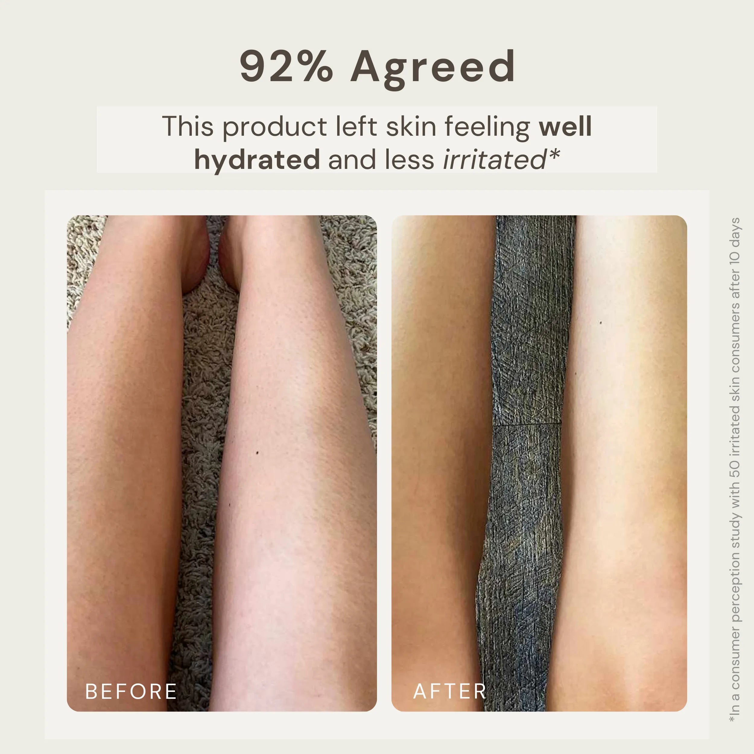 Before and after image showing the results of using Nature's Circle Care Marine Revival Soap. The 'Before' image shows irritated, red skin, while the 'After' image reveals visibly calm and even skin. Text highlights that 92% of users agreed the product left the skin feeling well hydrated and less and less irritated, based on a consumer perception study with 50 irritated skin consumers after 10 days.