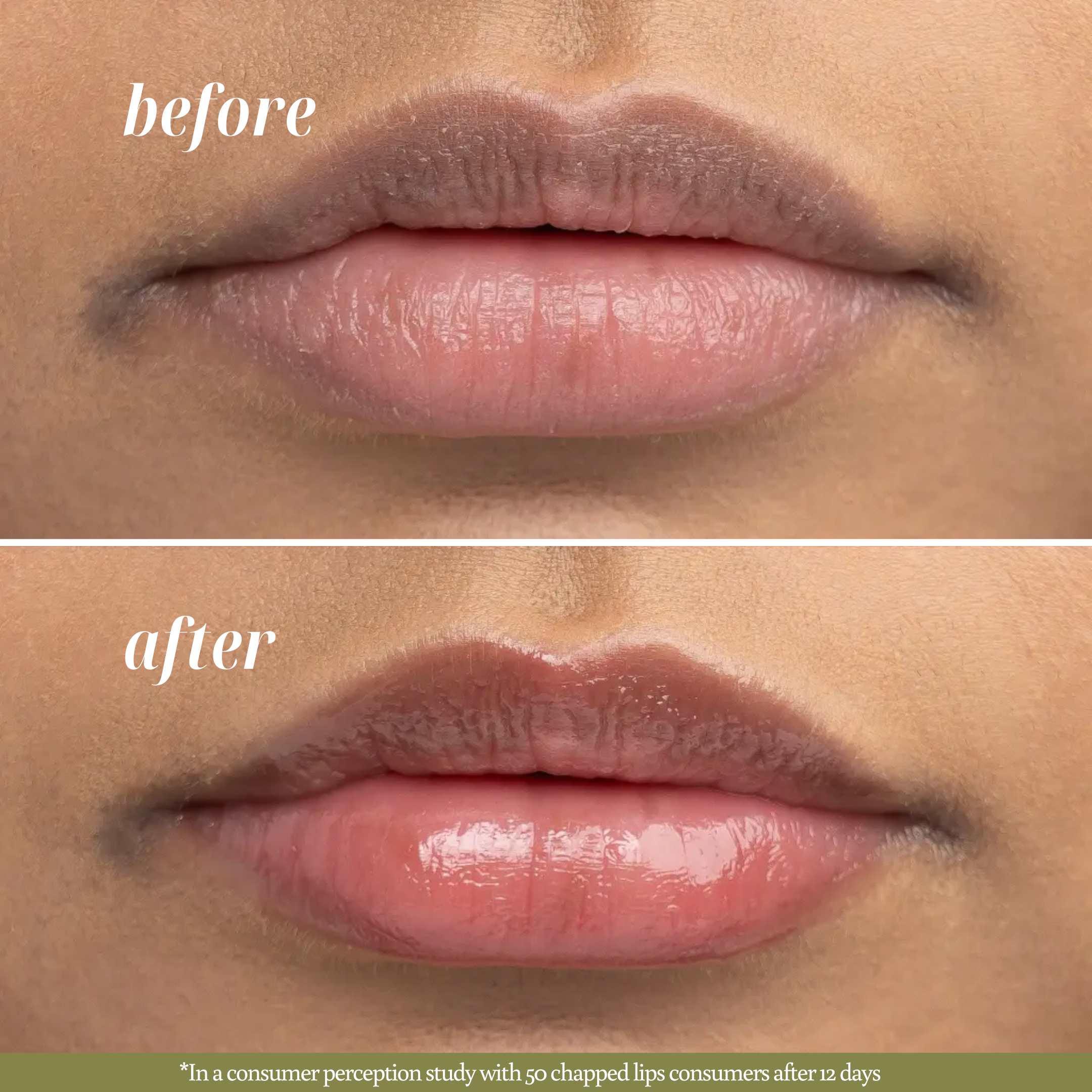 Close-up before-and-after image showing improvement in chapped lips after using Lip Mask/ Lip Balm. The ‘before’ lips appear irritated and peeled, while the ‘after’ lips look healed and moisturized.
