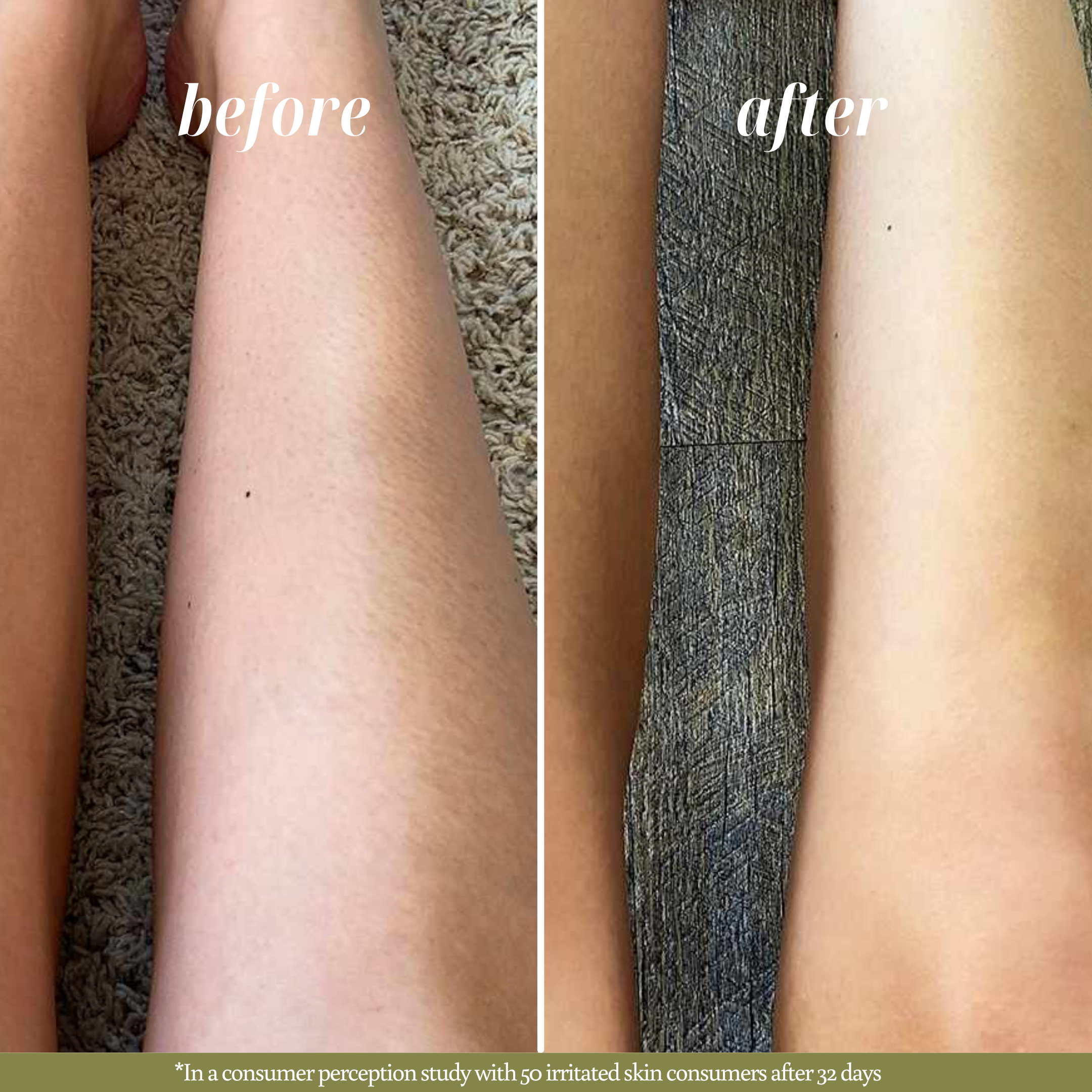Before and after images showcasing the results of Nature's Circle Care soap. The 'Before' image shows irritated skin. The 'After' image reveals visibly healthier moisturized, calm, and less irritated skin. 