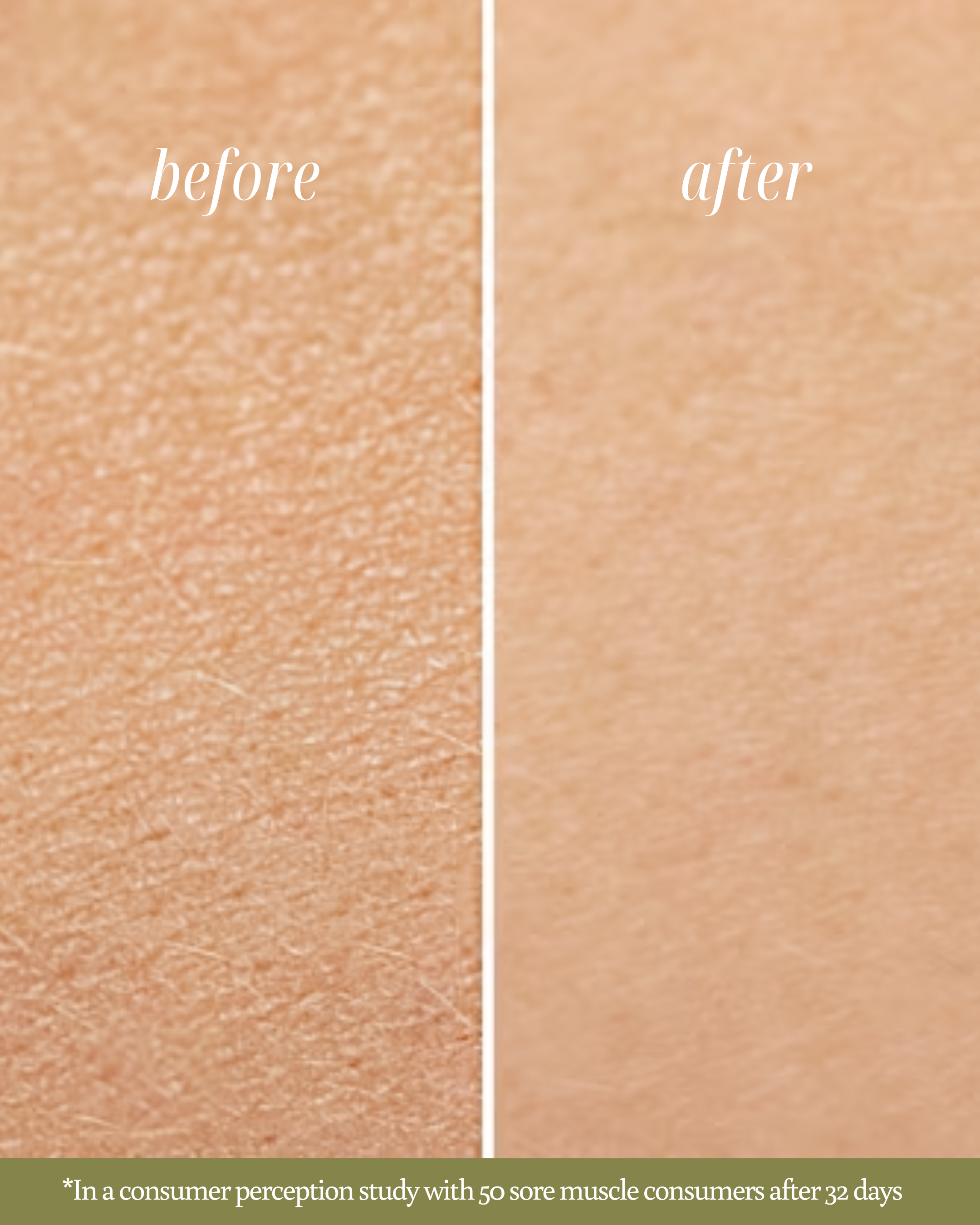 Before and after comparison of skin texture and sore muscle with text indicating a consumer perception study.