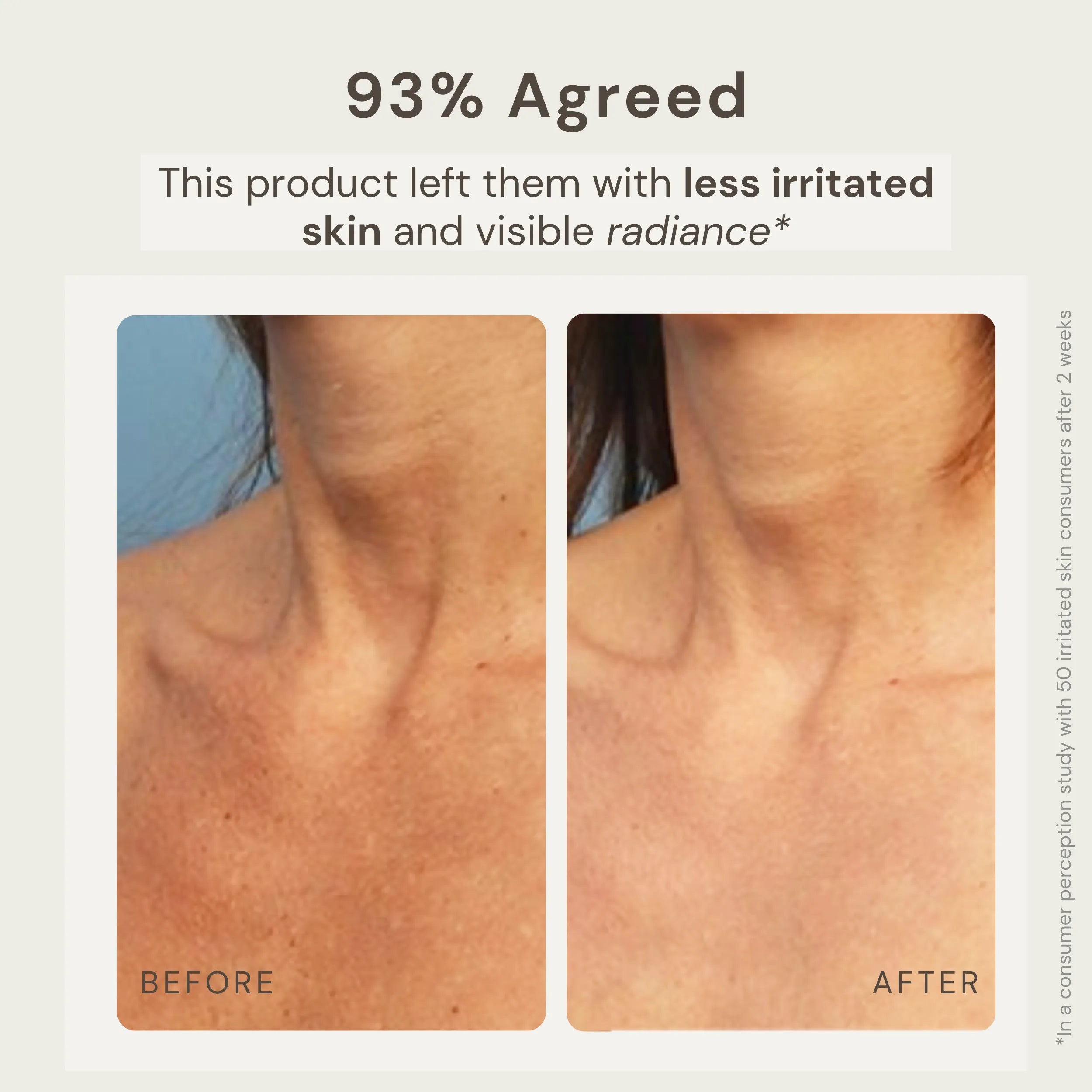 Before and after image showing the results of using Nature's Circle Care Rose Quartz Bath Salt. The 'Before' image shows irritated skin, while the 'After 2 Weeks' image reveals visibly radiant, calmer skin. Text highlights that 93% of users agreed the product left them with less irritated skin and visible radiance, based on a consumer perception study with 50 irritated skin consumers after 2 weeks.