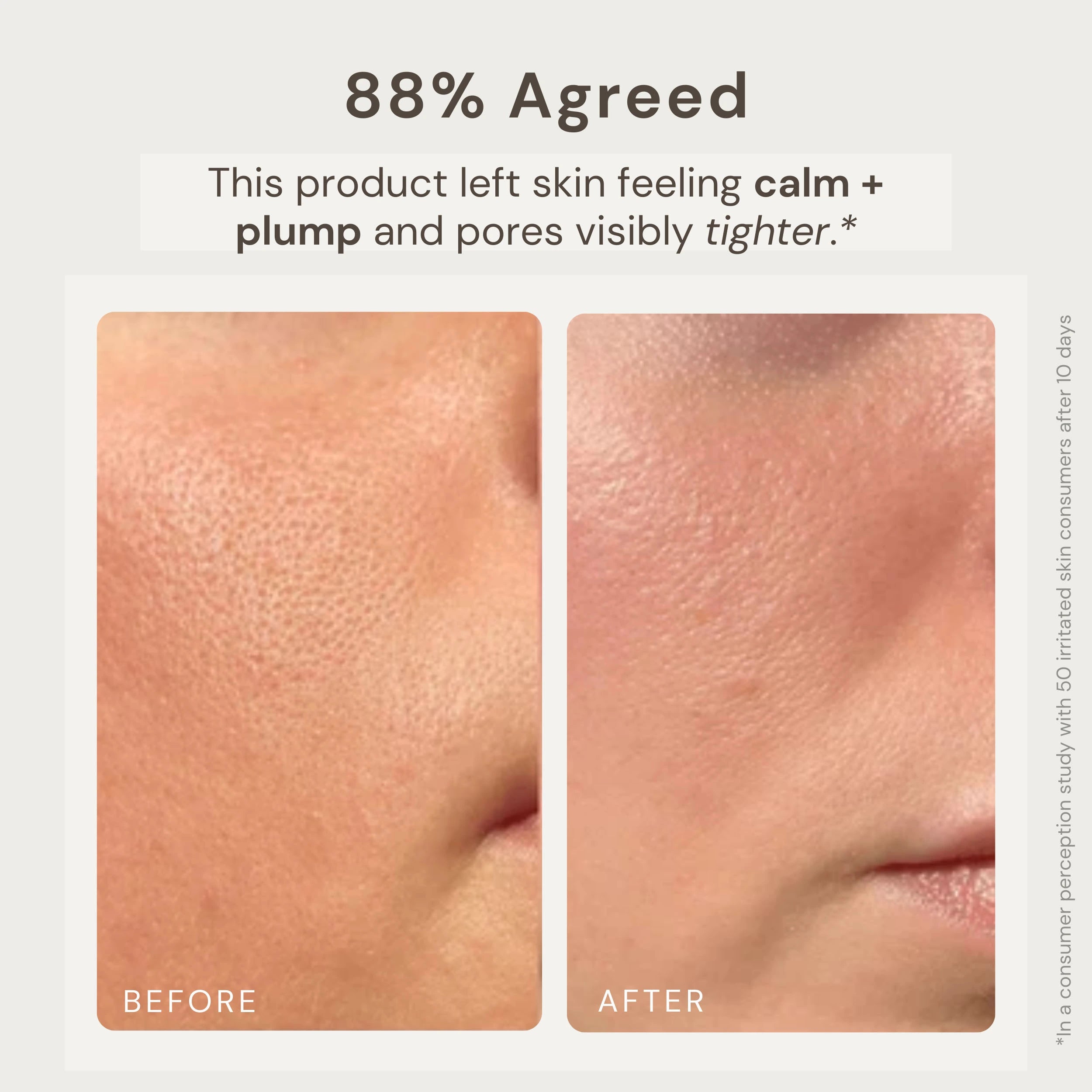 "Before and after image of a woman's side profile showing the results of using Nature’s Circle Care Rose Renewal Clay Mask. The 'Before' image displays irritated skin with visible pores, while the 'After 10 Days' image shows calmer, plumper skin with visibly tighter pores. Text highlights that 88% of users agreed the product left their skin feeling calm, plump, and with refined pores, based on a consumer perception study with 50 participants over 10 days.