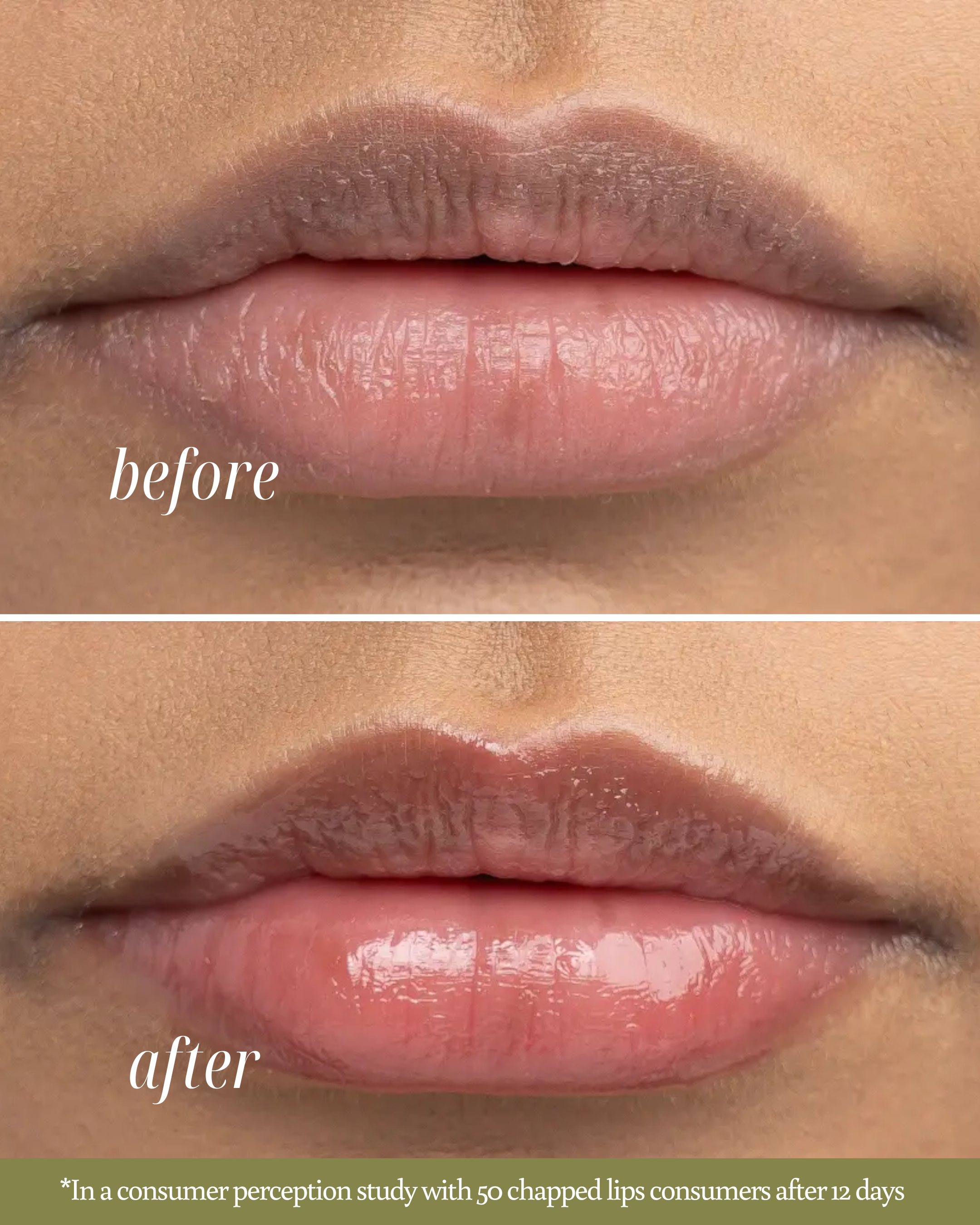 Close-up before-and-after image showing improvement in chapped lips after using Silk Therapy Lip Mask Balm. The ‘before’ lips appear irritated and peeled, while the ‘after’ lips look healed and moisturized.