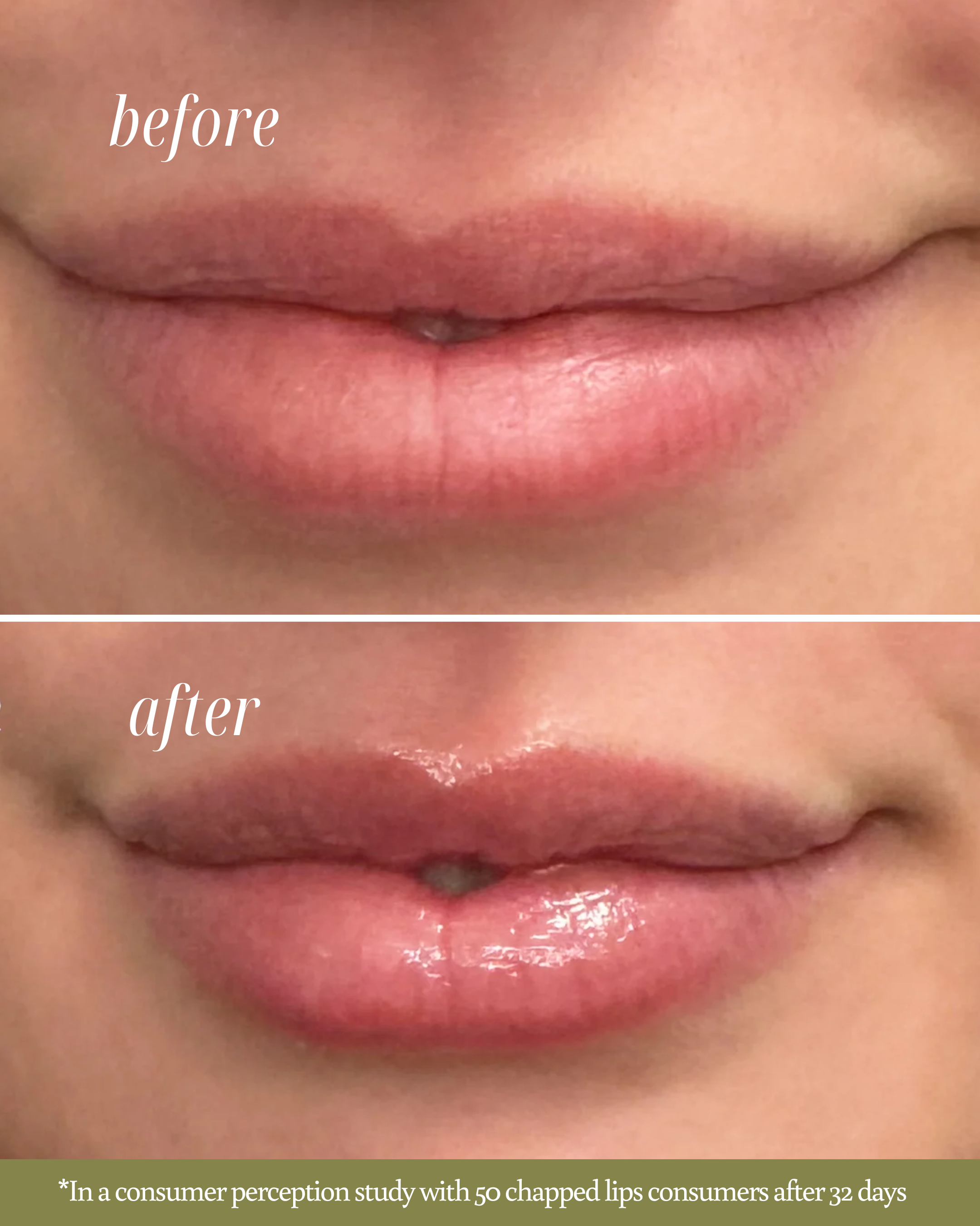 Close-up before-and-after image showing improvement in chapped lips after using Tropical Bliss Lip Balm. The ‘before’ lips appear dry and flaky, while the ‘after’ lips look smoother and moisturized.