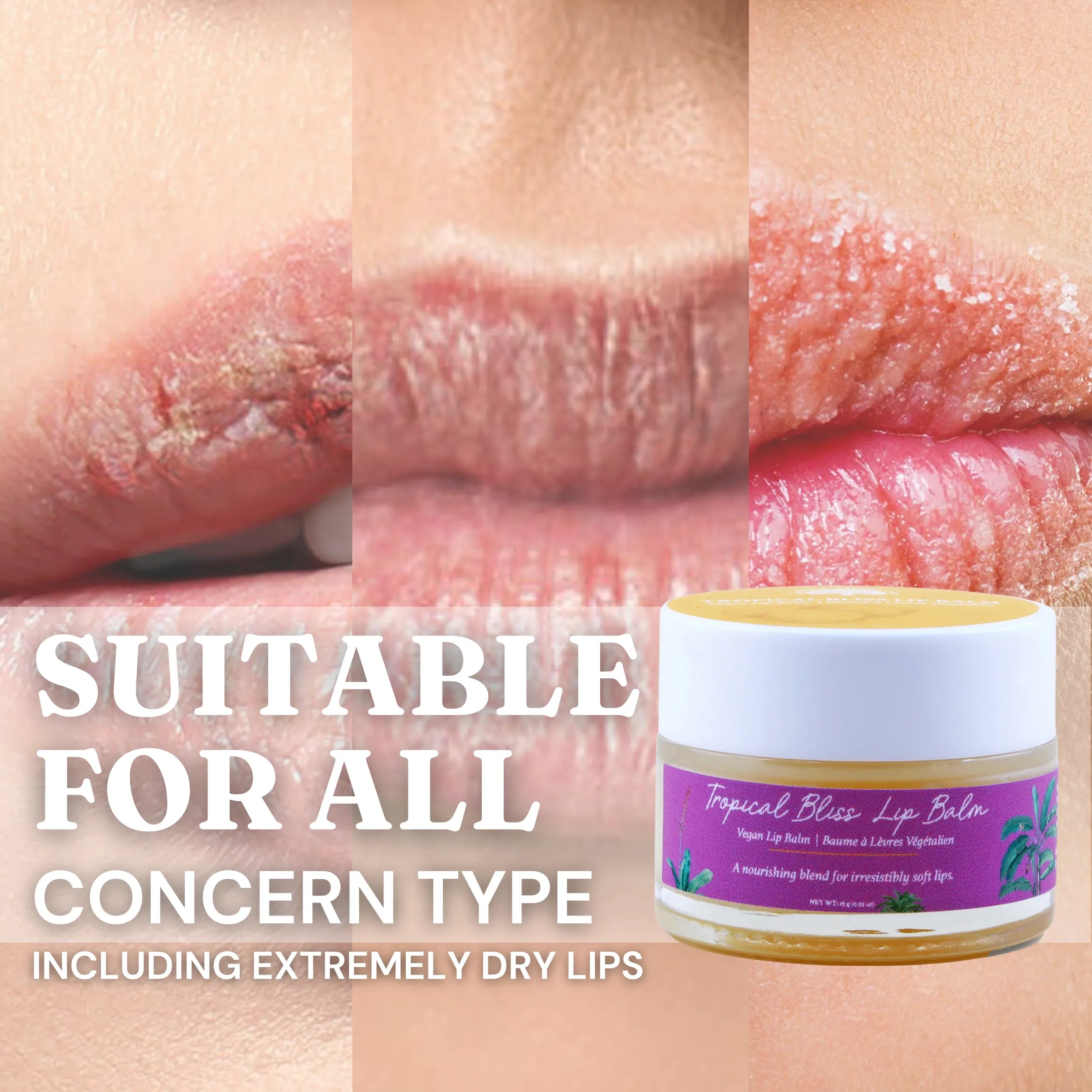 Showing various types of lips in the background with the Tropical Bliss Lip Balm jar on the right. The text reads: 'Suitable for all concern types, including extremely dry lips.' The product is designed to address a variety of lip care needs, providing nourishment and hydration.